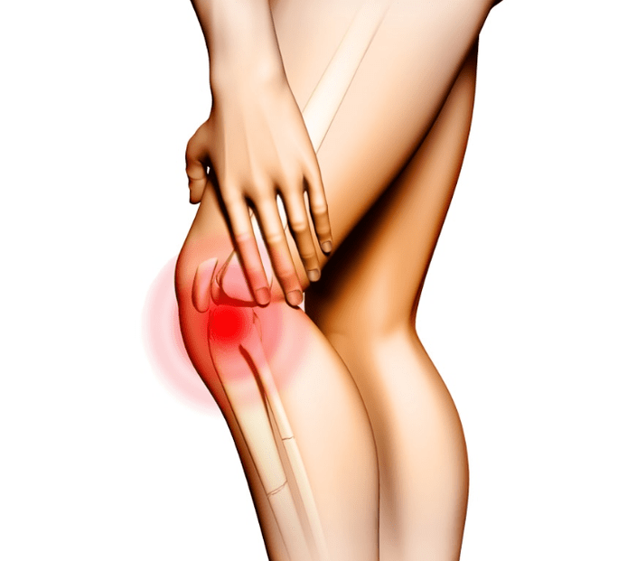 Stadien der Arthrose
