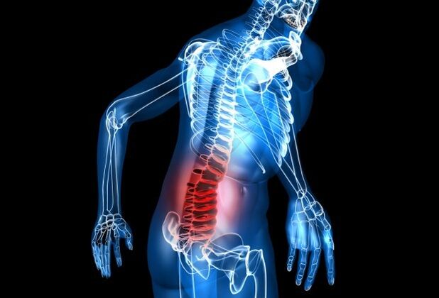 Symptome der Osteochondrose