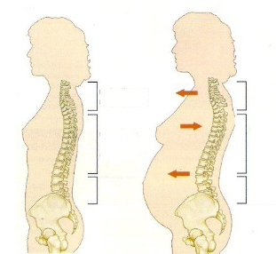Osteochondrose während der Schwangerschaft